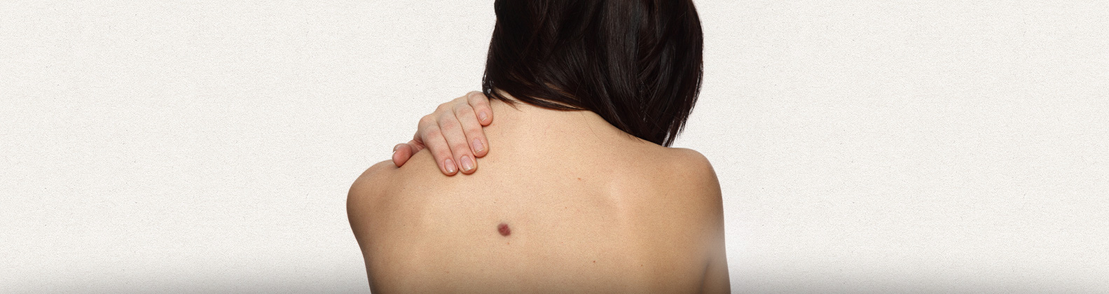 Câncer de pele | Dr. Rodrigo Pimenta